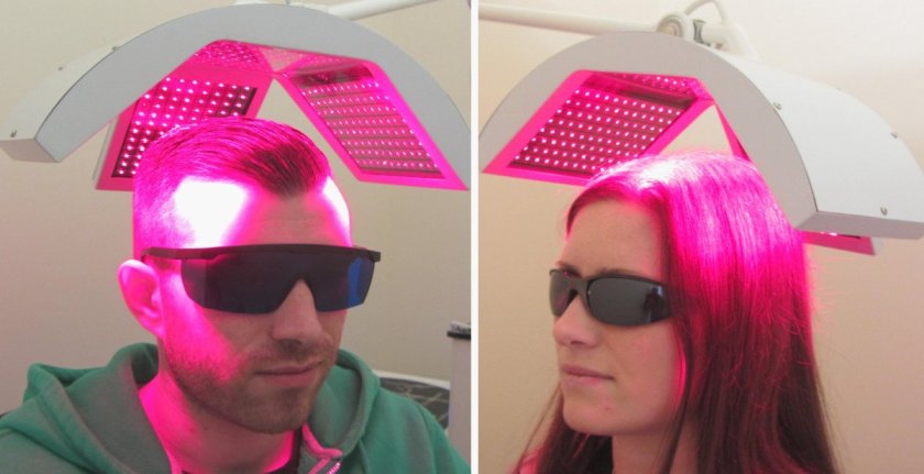 laser_hair_regrowth_therapy
